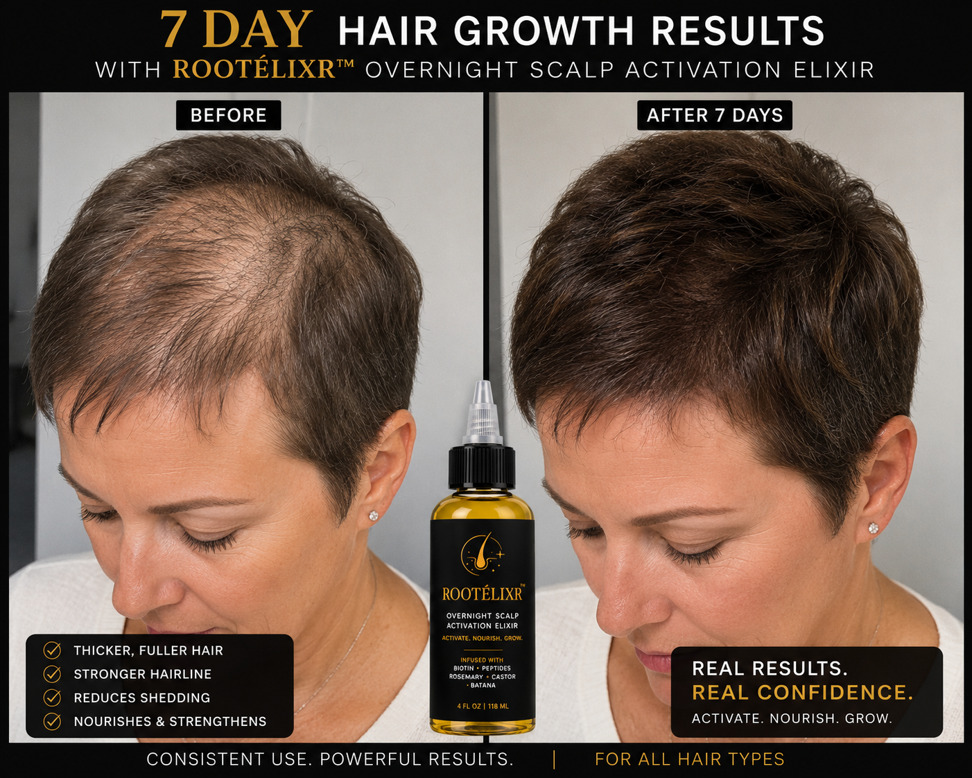 Rootelixr Hair Oil/Plastic Bottle